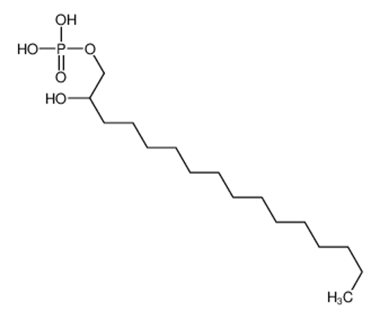 Picture of 2-hydroxyhexadecyl dihydrogen phosphate